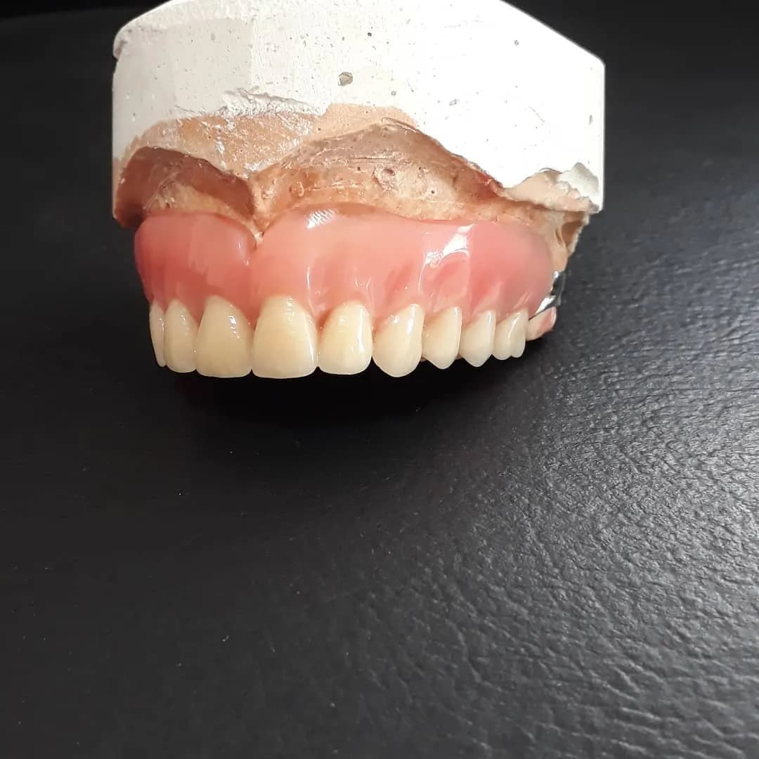 Prótese dentária sobre modelo de gesso