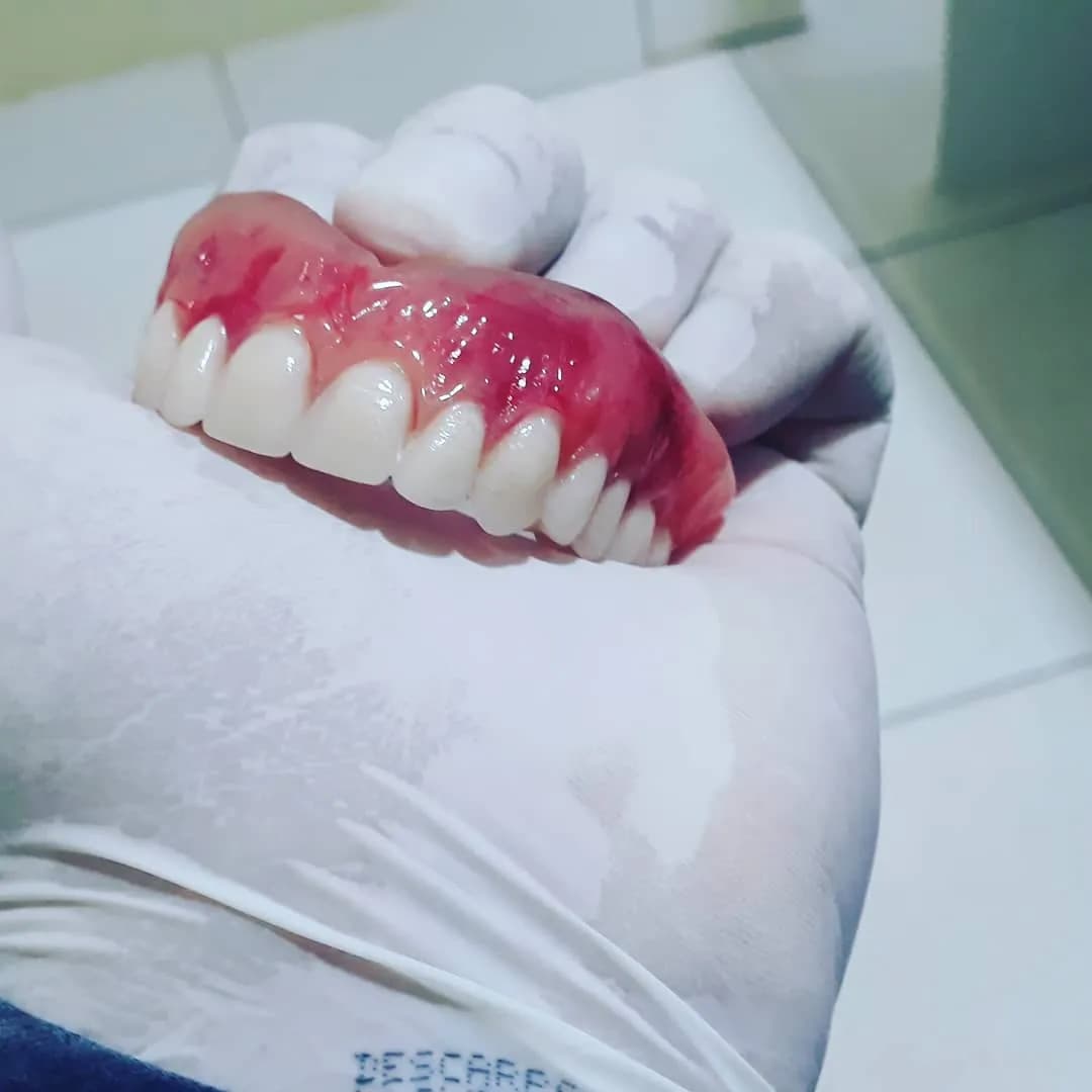 Prótese dentária superior