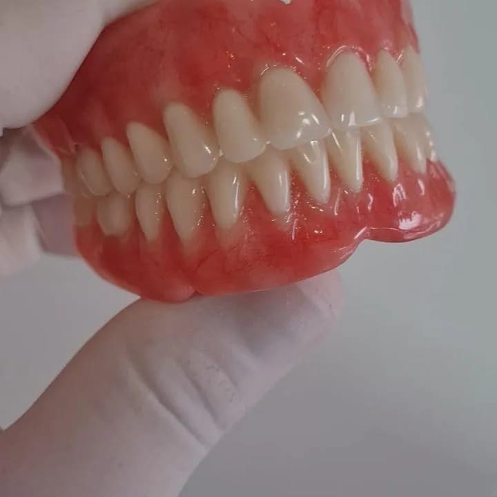 Prótese dentária total