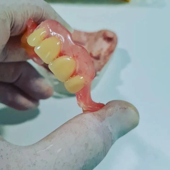 Prótese dentária flexível