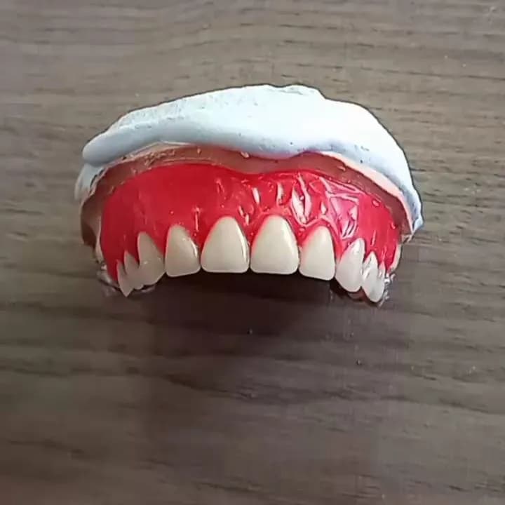 Prótese dentária total