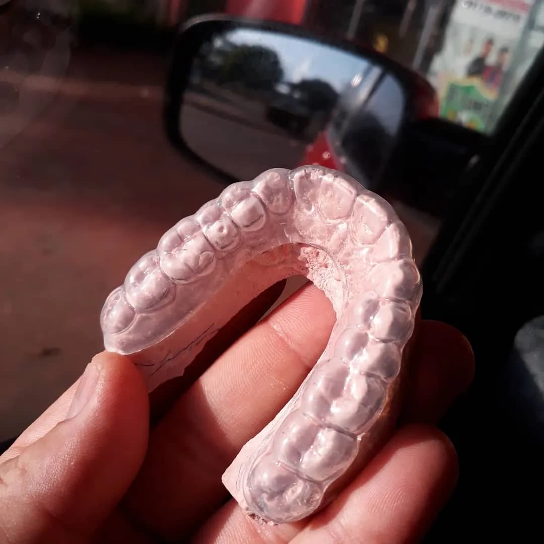 Moldeira de clareamento dental