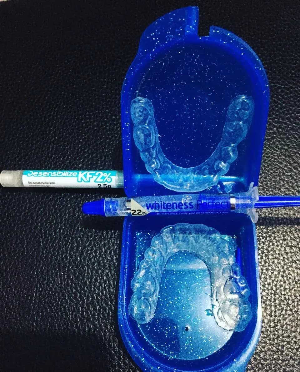 Moldeiras de clareamento dental